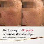 Before and after images showing the transformative effects of SK-II PITERA Facial Treatment Essence, highlighting improved skin radiance and texture.