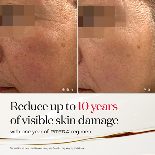 Before and after images showing the transformative effects of SK-II PITERA Facial Treatment Essence, highlighting improved skin radiance and texture.
