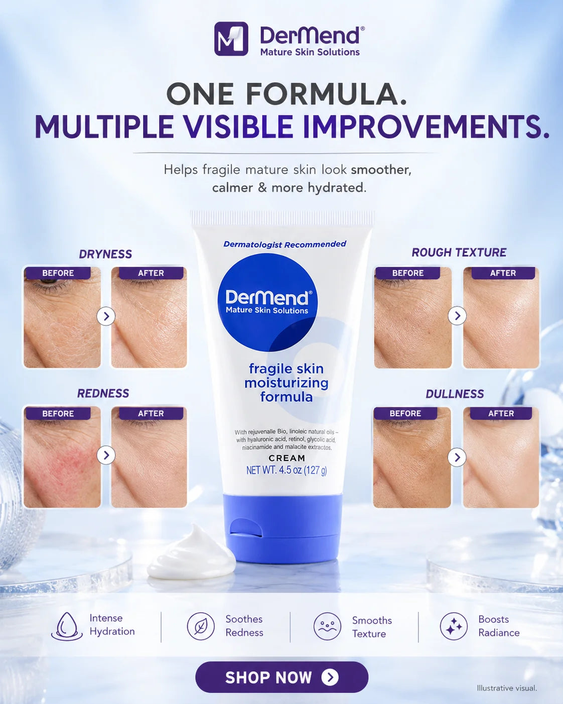 DerMend Fragile Cream