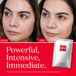 SK-II Facial Treatment Mask, 10 ct