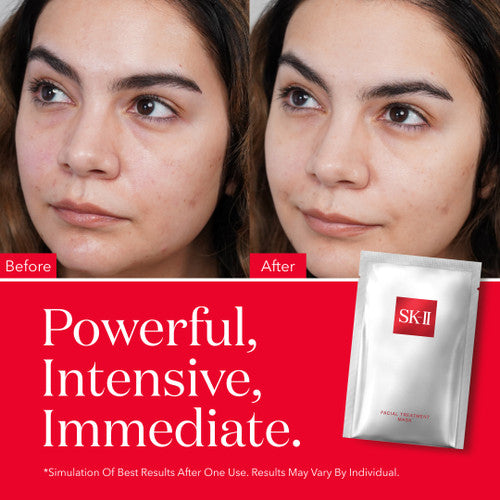 SK-II Facial Treatment Mask, 10 ct